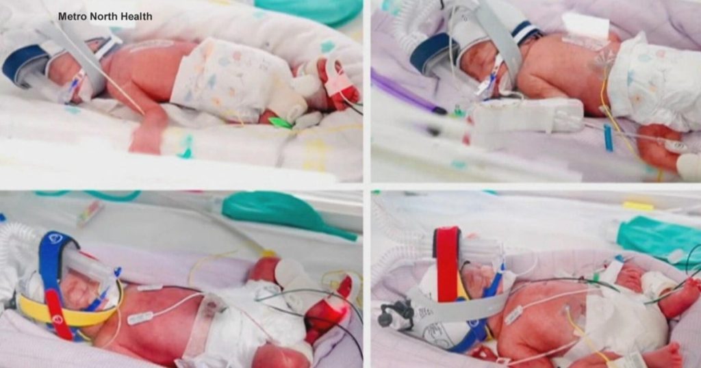 cbsn-fusion-australian-woman-gives-birth-to-rare-identical-quadruplets-thumbnail.jpg