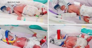 cbsn-fusion-australian-woman-gives-birth-to-rare-identical-quadruplets-thumbnail.jpg