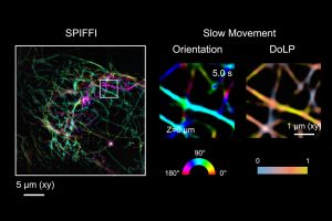 spiffi-microscope-living-cells-real-time.jpg